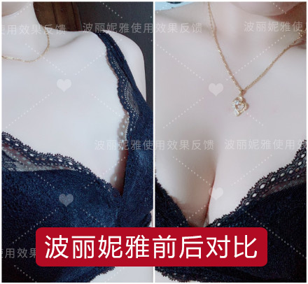 怎样才能让乳房更大?学会这些帮你成就丰满的自己