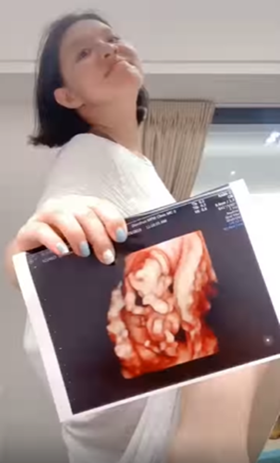 л���ػ���̥ʲô��� �⵽������ô����?