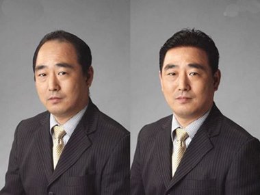 男士发片容易看出来吗? 男士前额发片