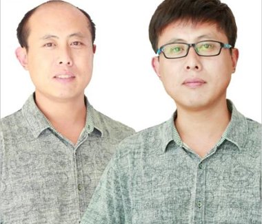 男士发片容易看出来吗? 男士前额发片