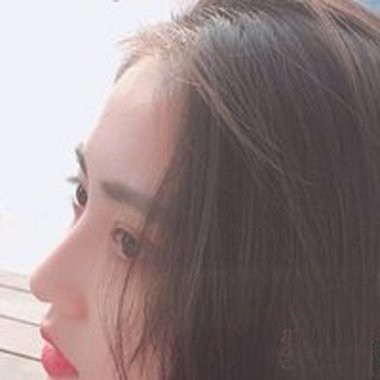 �����ػᵼ�µ�ͷ���� ʹ�û����ص�Σ������Щ