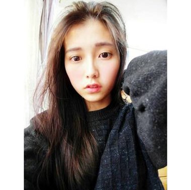 脂溢性脱发能植发吗 女性脂溢性脱发