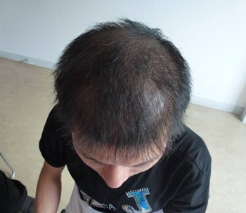 �ѷ��Ժ�֥������� ��ô�Ժ�֥�������ѷ�