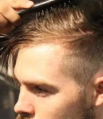 ��ͷ��ʲô���Ӵ��������� �����ʦ������ʿ��ͷ���ӵ��÷��̳�